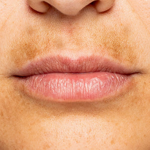 Dark & Pigmented Lips