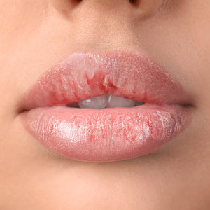 Best Lip Balm for Hydration and Severely Dry Lips